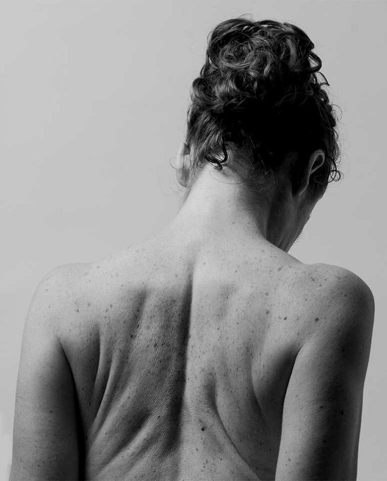 ¿Por qué asistir a terapia psicocorporal? Pilar Aguilar de espaldas libertarte.es